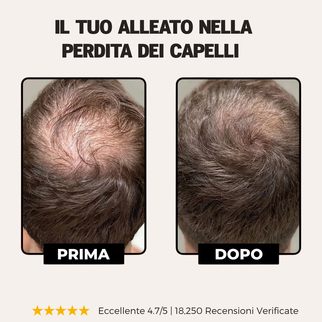 Shampoo Attivatore delle Radici – BOLTIFY™